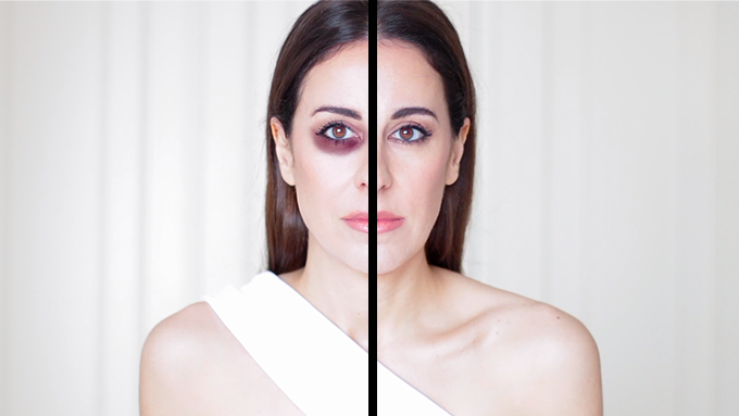 COMO ELIMINAR LAS OJERAS