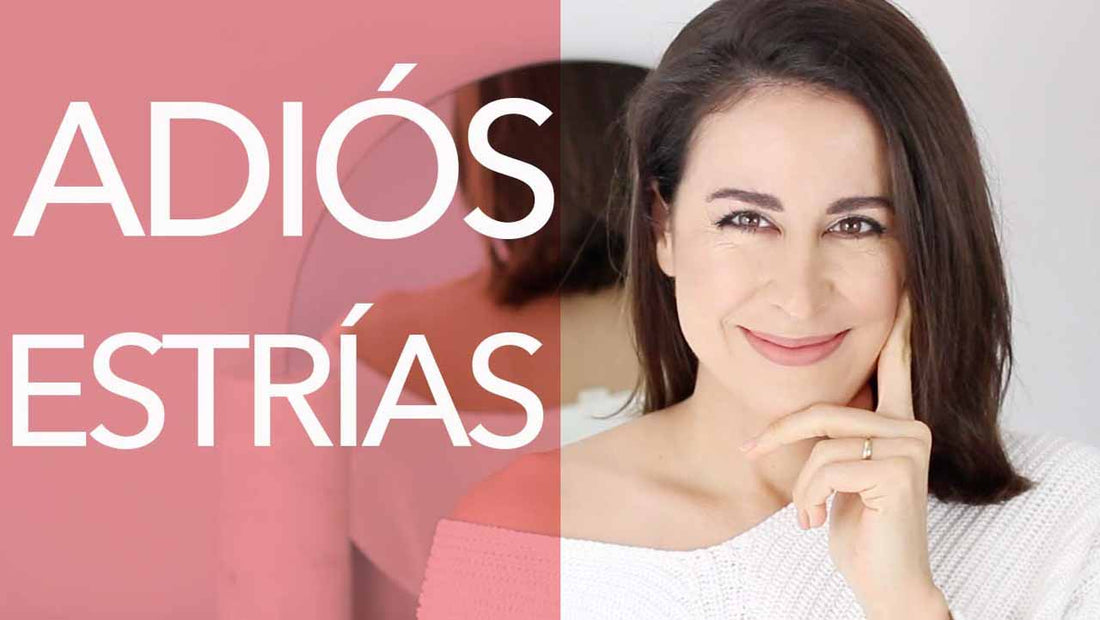 Estrías, como tratarlas y prevenirlas.