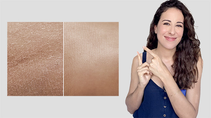 Como acabar con la Piel Seca: productos asequibles y rutinas fáciles que funcionan.