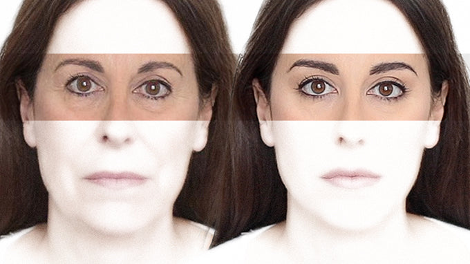 Favoritos para el contorno de ojos