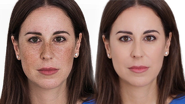 ¿Cómo eliminar las manchas?